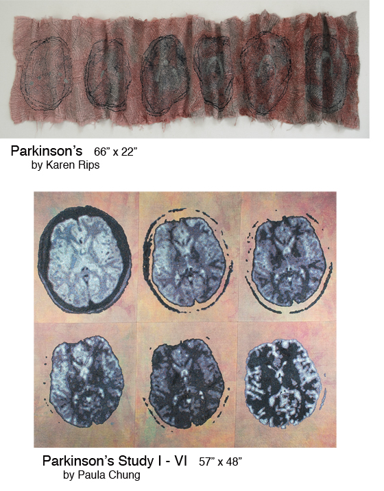 Parkinson's Studies