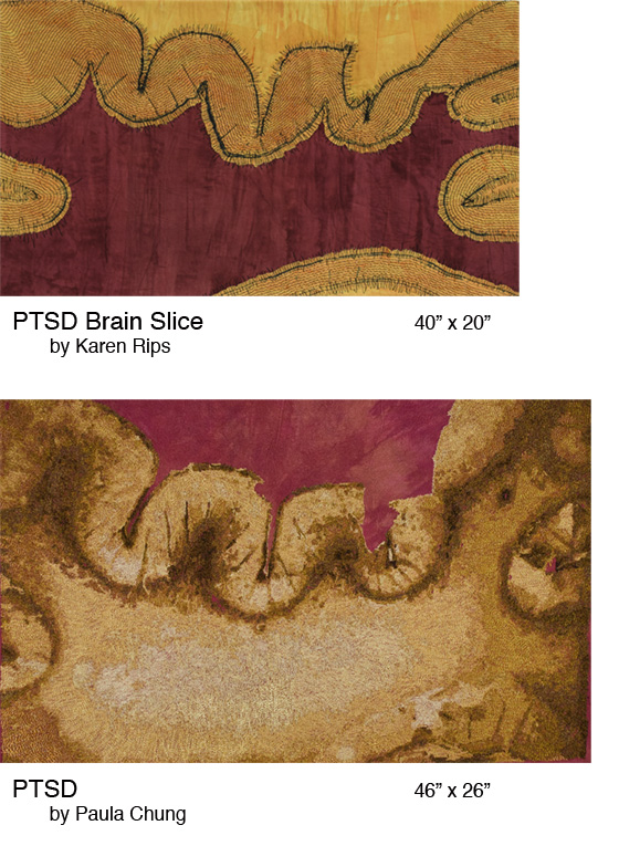 PTSD Brain Slice/PTSD