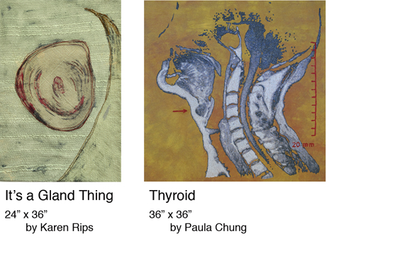 Its a Gland Thing - Thyroid