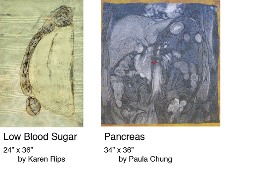 Low Blood Sugar - Pancreas