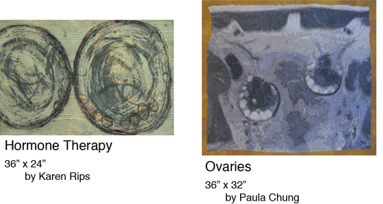 Hormone Therapy - Ovaries