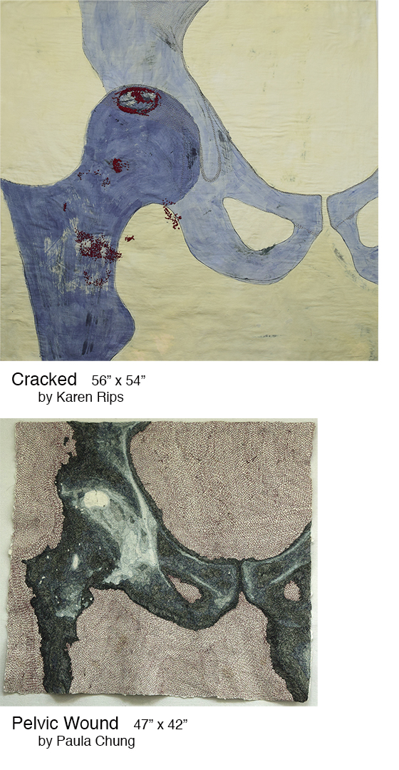 Cracked/Pelvic Wound