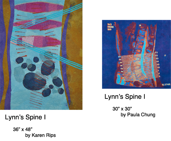 Lynn's Spine I